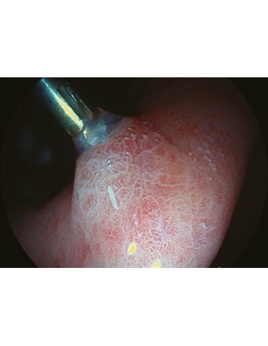 Torre de Endoscopia Sonoscape 550 4LED